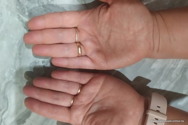 Гадюки действительно убивают? Истории реальных белорусов, которых кусала змея Гадюки действительно убивают? Истории реальных белорусов, которых кусала змея