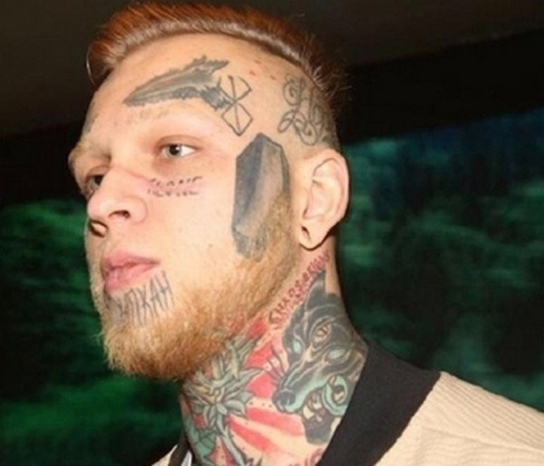 Как выглядит лицо после удаления татуировки