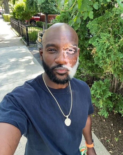 На этих фото показали, какие финты генетика вытворяет с людьми На этих фото показали, какие финты генетика вытворяет с людьми