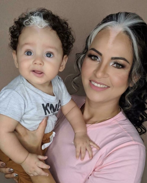 На этих фото показали, какие финты генетика вытворяет с людьми На этих фото показали, какие финты генетика вытворяет с людьми