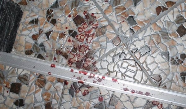 Была недовольна его образом жизни. В Беларуси сын ударил мать ножом в голову — она в реанимации Была недовольна его образом жизни. В Беларуси сын ударил мать ножом в голову — она в реанимации