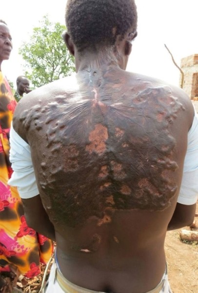 После разряда — что происходит с человеком, в которого ударила молния После разряда — что происходит с человеком, в которого ударила молния