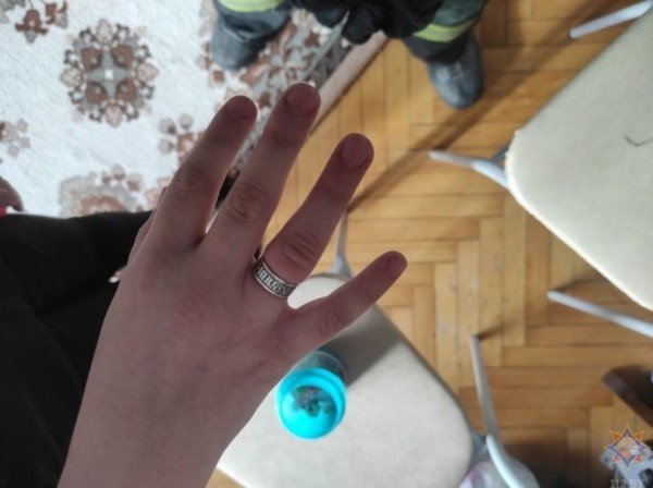 В Беларуси спасатели помогли снять застрявшее кольцо с пальца 8-летней девочки. Смотрите видео и фото В Беларуси спасатели помогли снять застрявшее кольцо с пальца 8-летней девочки. Смотрите видео и фото