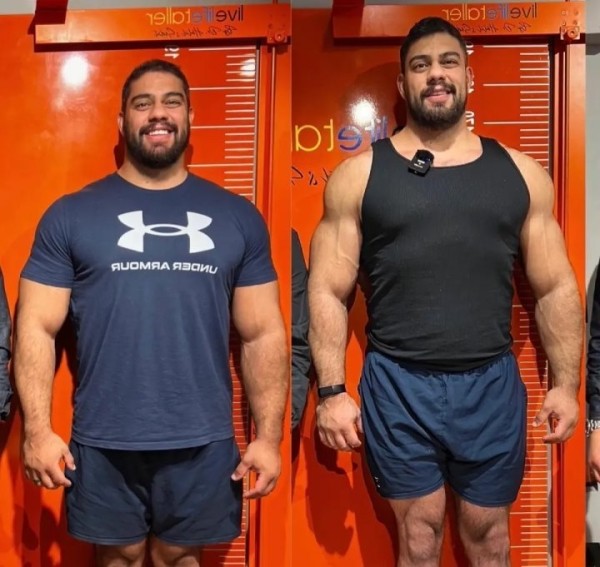 Мужчина потратил 100 тысяч евро, чтобы увеличить свой рост. «Вырос» до двух метров Мужчина потратил 100 тысяч евро, чтобы увеличить свой рост. «Вырос» до двух метров