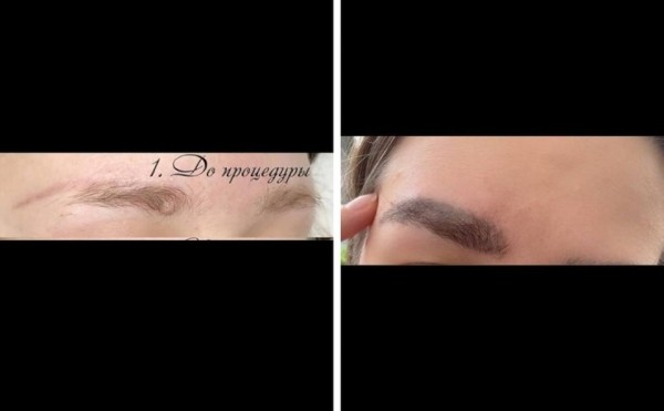 Белоруска сделала пересадку бровей. Ролик с последствиями собрал почти полмиллиона просмотров Белоруска сделала пересадку бровей. Ролик с последствиями собрал почти полмиллиона просмотров